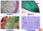 一滴血检测仪郑州MDI-301M一滴血检测仪厂家